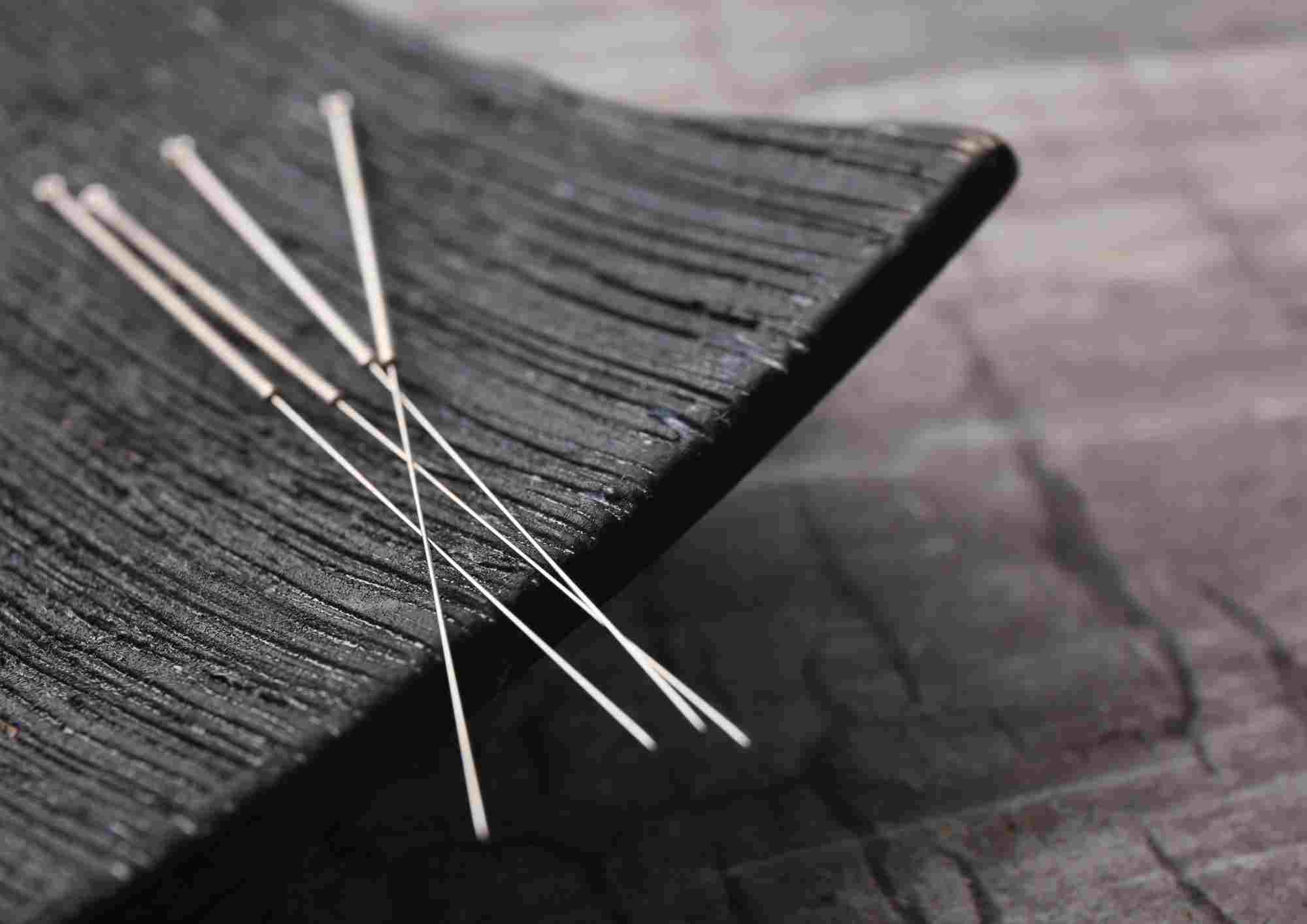 dry needling vs acupuncture